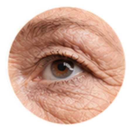 Wrinkles