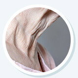 Aging Skin